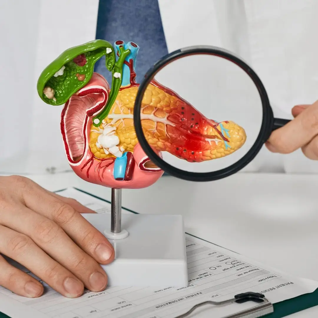 Bile Duct Disease Treatment