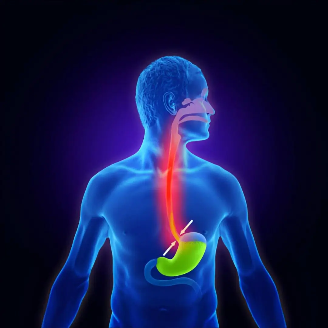 Esophageal Dilation