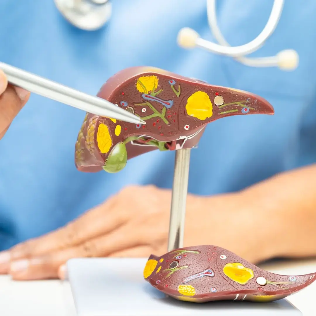 Cirrhosis Management