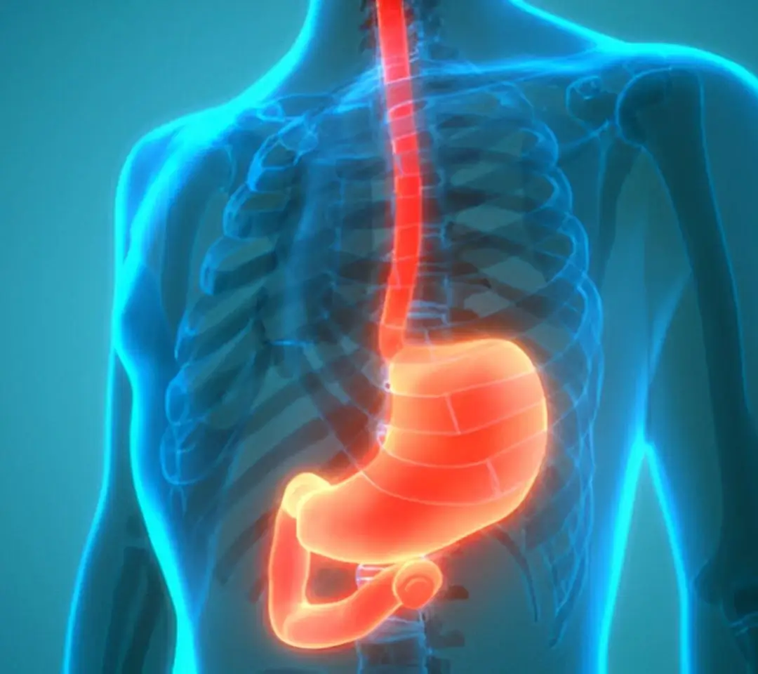 Barrett’s Esophagus Treatment