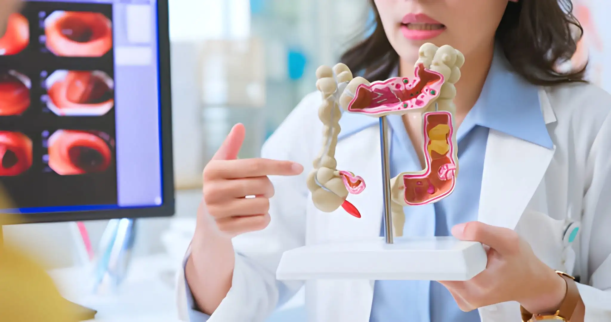 Colon Cancer & Polyps Treatment