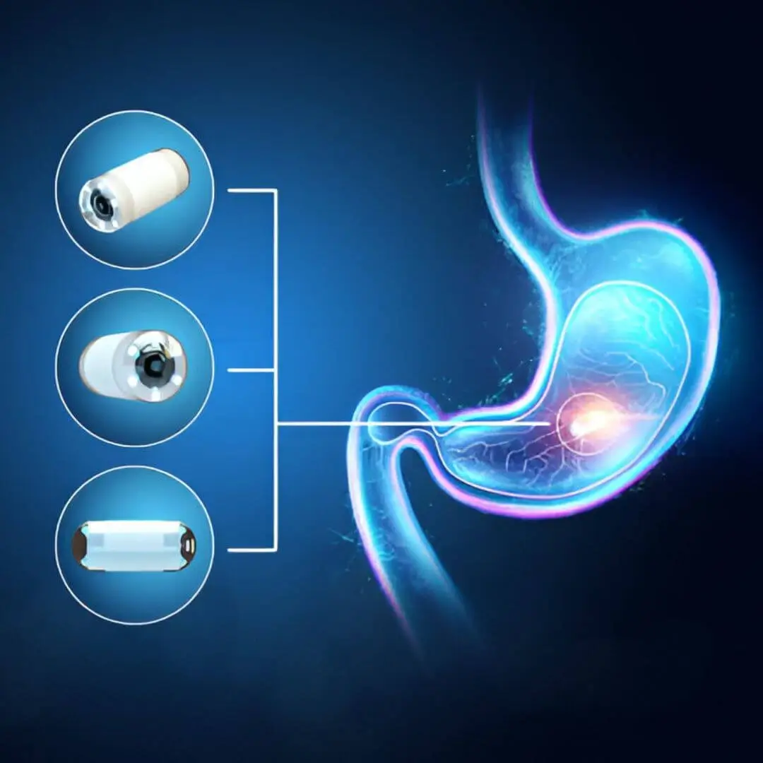 Capsule Endoscopy