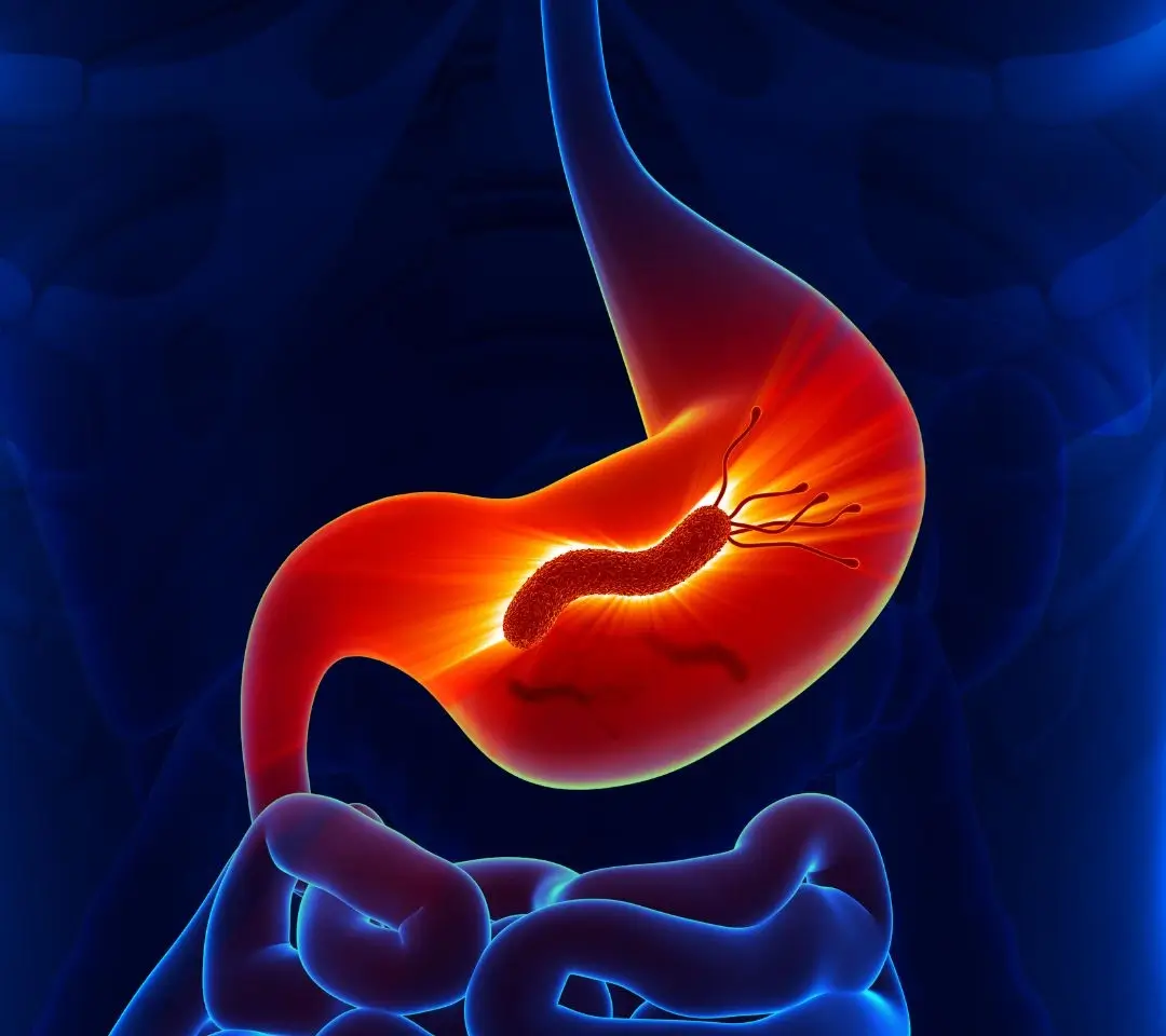 H. Pylori Testing & Treatment