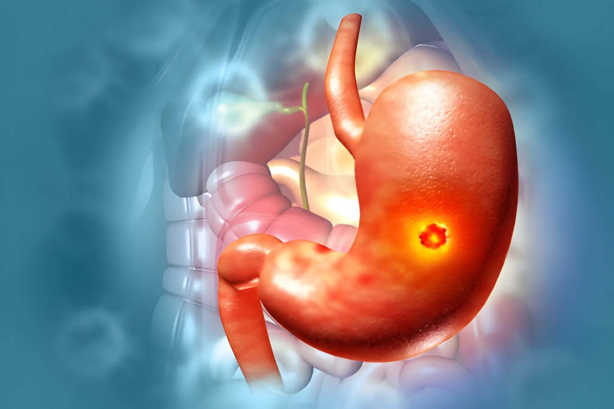 Heartburn & Acid Reflux Treatment