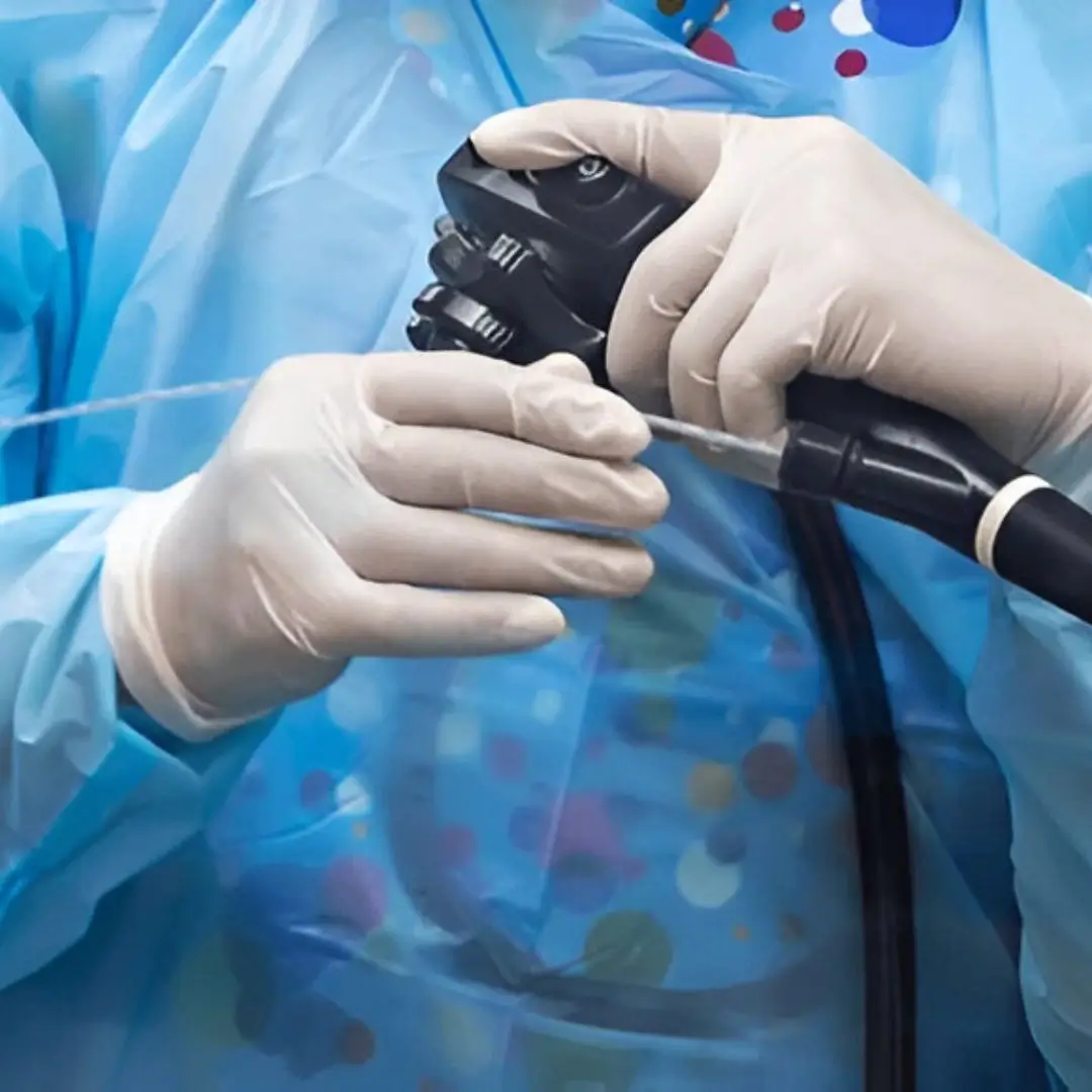 Endoscopic Retrograde Cholangiopancreatography